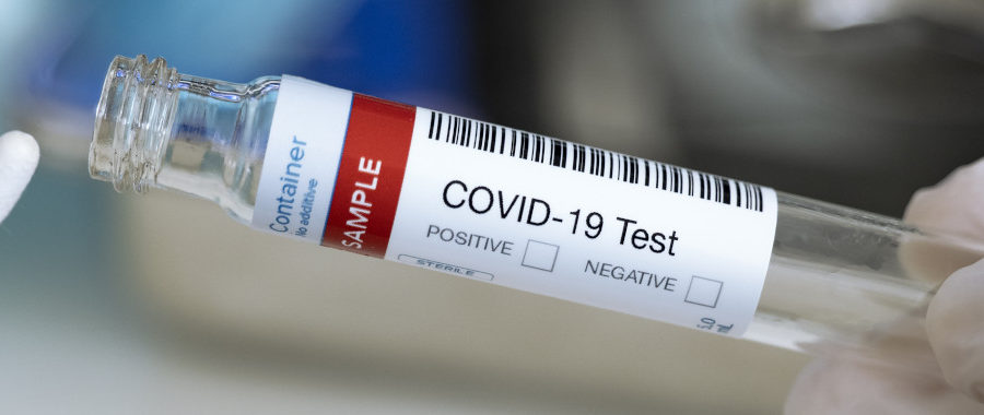 Corona Antigen Teströhrchen