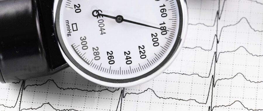 Blutdruckmessgerät auf einem EKG-Ausdruck